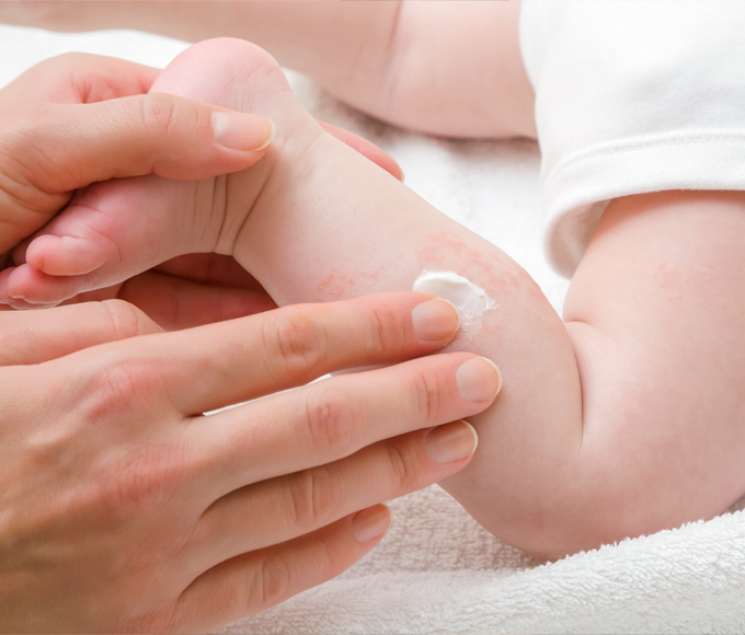 赤ちゃんの足にクリーム塗布